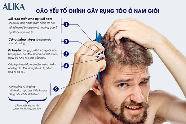 Nguyên nhân rụng tóc ở nam giới