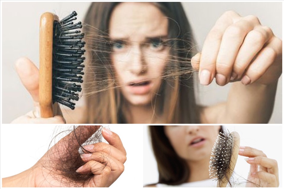 Nguyên nhân rụng tóc do thiếu dưỡng chất