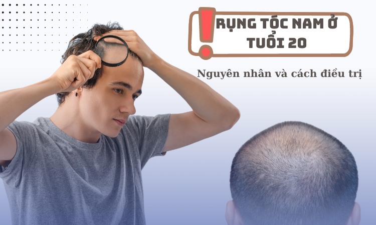 Điều trị rụng tóc ở Nam giới